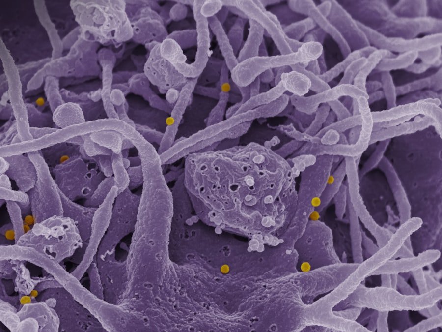 Antimicrobial Resistance