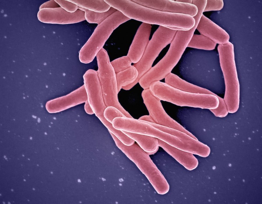 Photo Antimicrobial Resistance